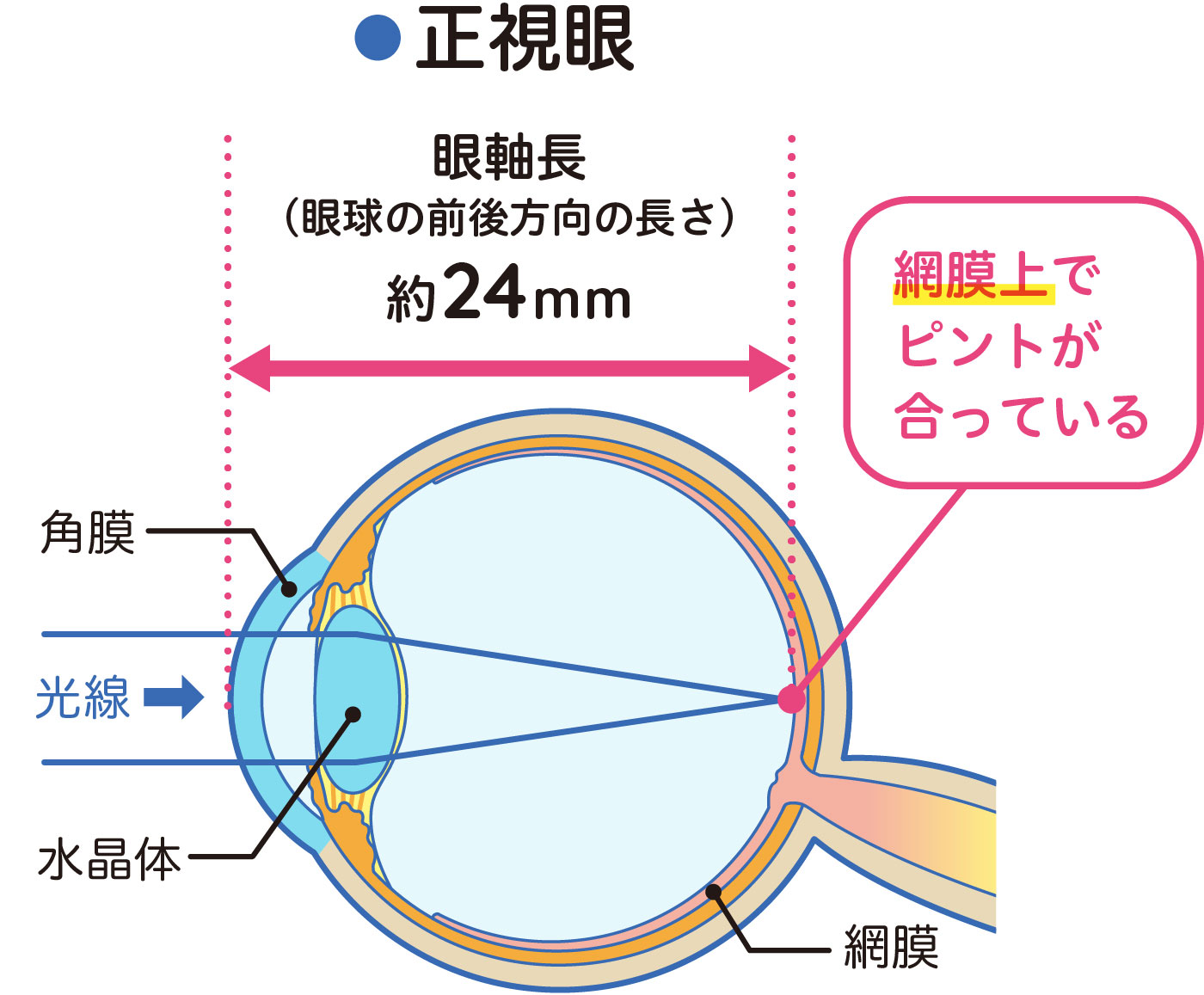 正視眼